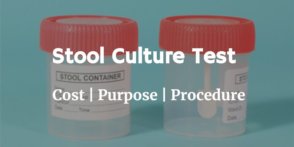 Know more about the stool culture test including the stool culture cost and the purpose and procedure of the test.