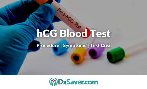 Blood Test (hCG Qualitative)