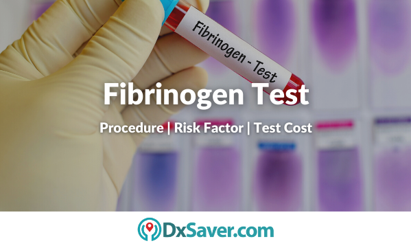 Fibrinogen Test