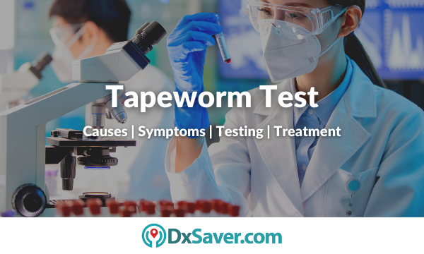 Tapeworm Test