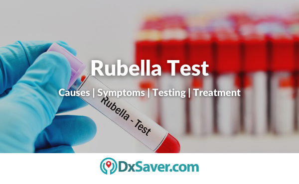 Rubella Test