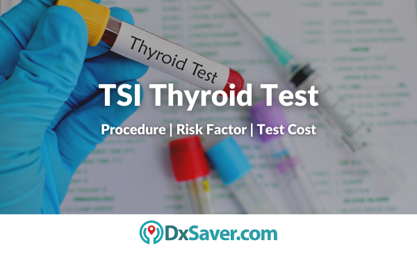 TSI Thyroid Test