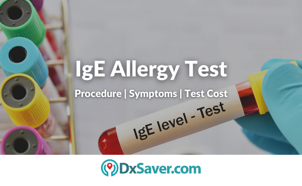 IgE Allergy Test