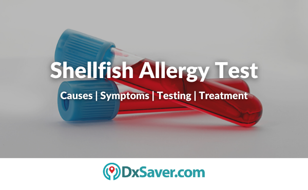 Shellfish Allergy Test