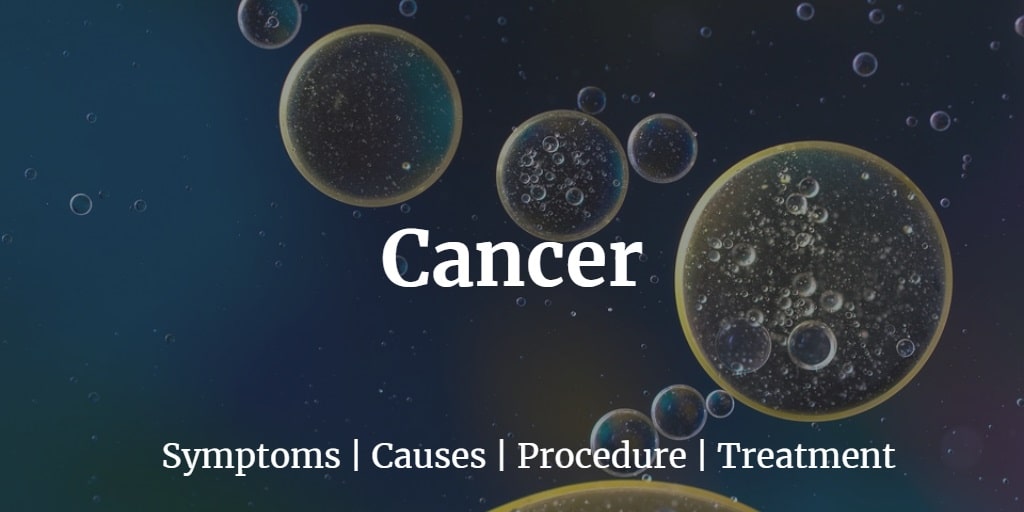 Know more about the cancer prevalence in the U.S. including cancer screening test cost.