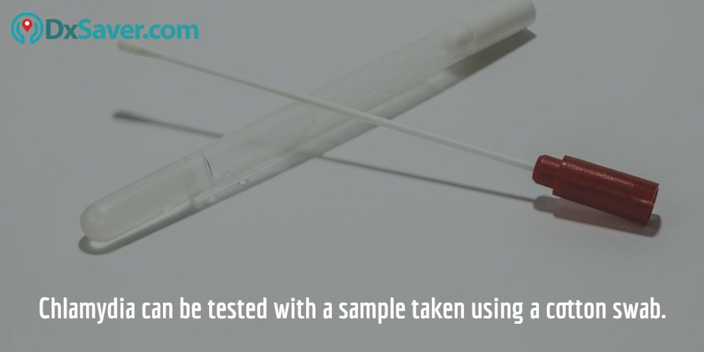 Image shows the cotton swab which is used to take a sample for Chlamydia testing.