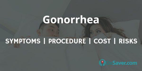 Get Lowest Gonorrhea Test Cost at $79. Know more about the signs of gonorrhea, oral gonorrhea, test procedure & risks. 