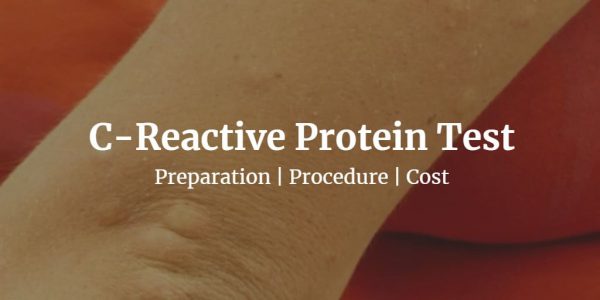 Know about the C reactive protein test like the CRP test cost, normal CRP levels, & more.