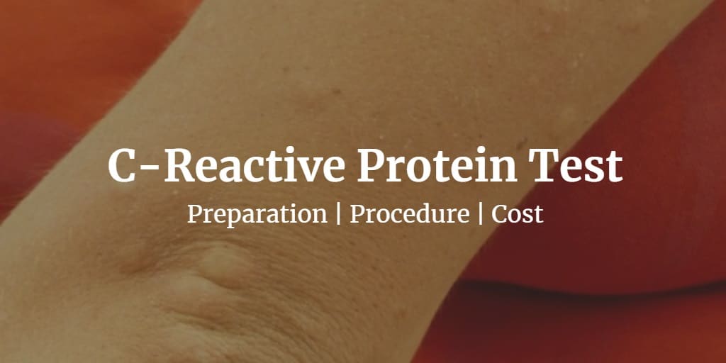 Know more about the C reactive protein test including the cost, procedure, and preparation.