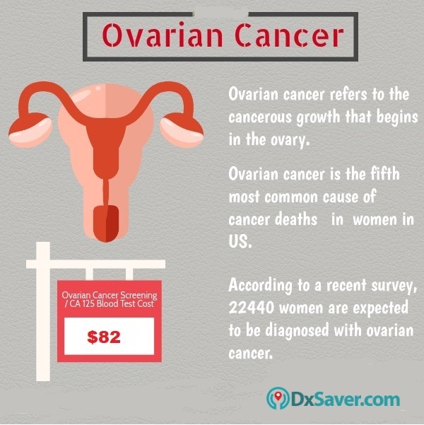 Know more about the prevalence of ovarian cancer in the U.S. and the ovarian cancer screening test, CA 125 test cost.