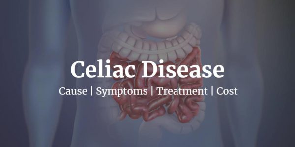 How to test for Celiac disease? Know more about symptoms, treatment, and celiac disease test cost.