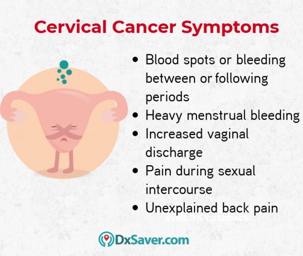 Know more about the cervical cancer signs and symptoms in its advanced stages.