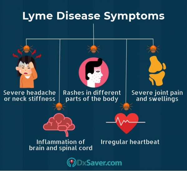 Know more about the Lyme disease stages in human and symptoms.