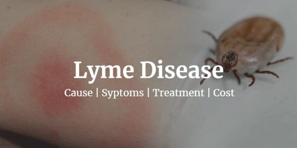 Know more about the Lyme disease like the Lyme disease test cost, symptoms, stages, and cure.