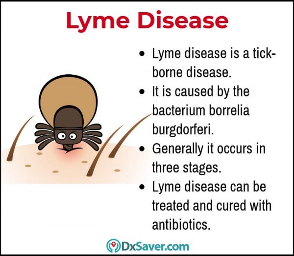 Know more about the important facts of Lyme disease and causes.