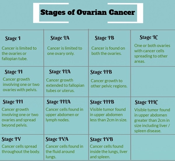 Know about the ovarian cancer stages and more about the 4 stages of ovarian cancer.