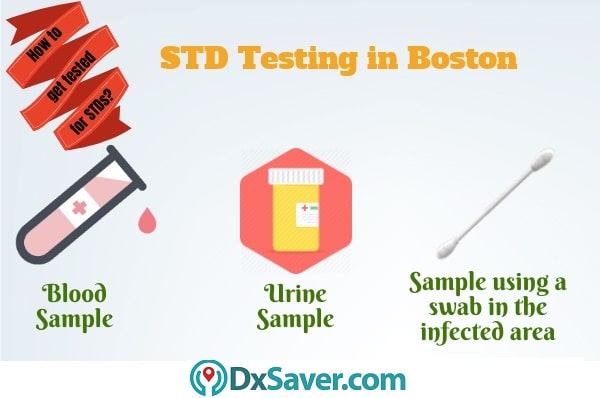 Know about the different methods to check for STDs and STD treatment near me