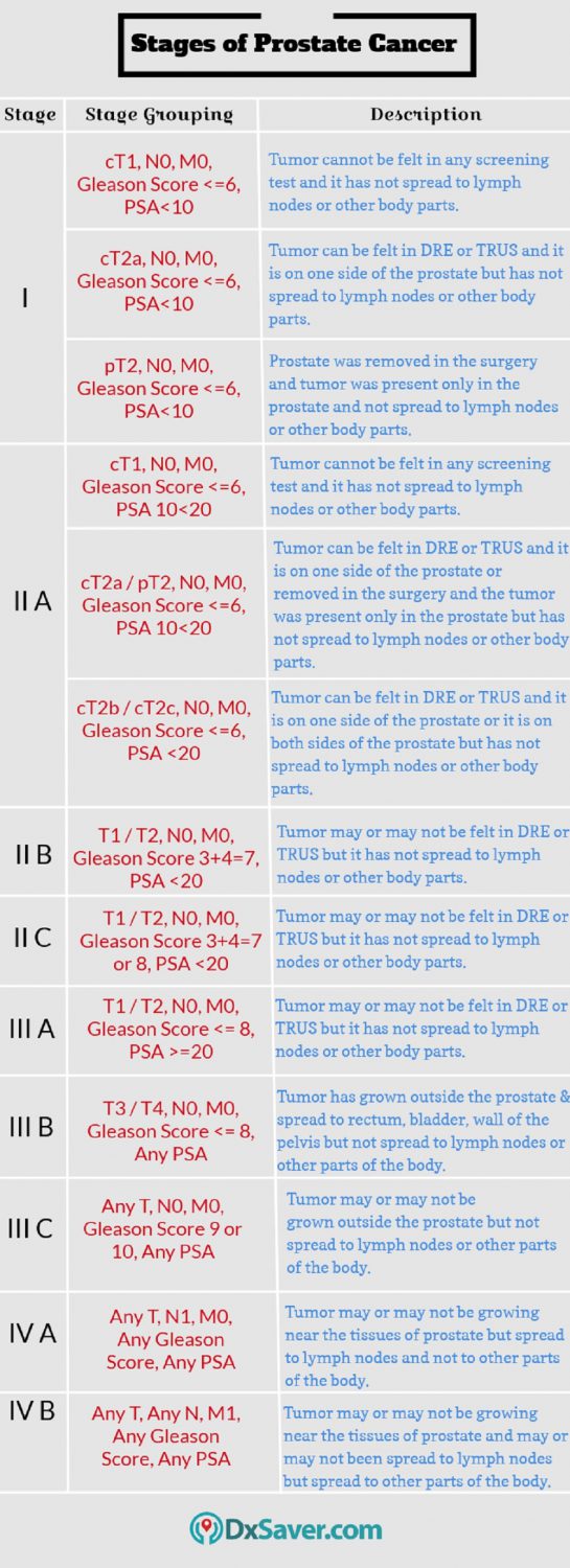 Know more about the 4 stages of prostate cancer.