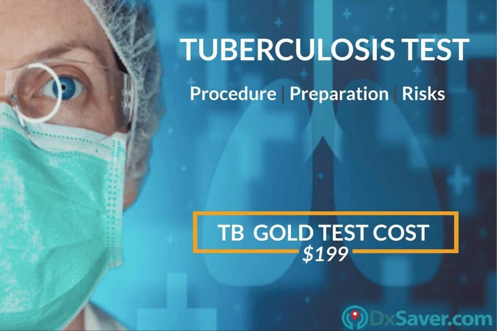 TB Gold Test Price or Quantiferon TB Gold Test Cost