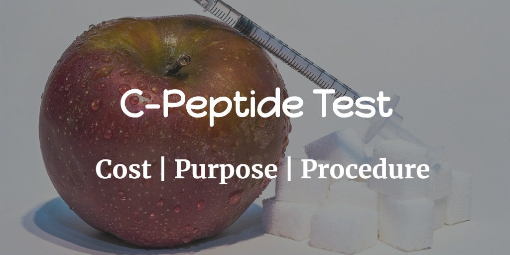 Know more about the C-Peptide test including the C-peptide test cost, purpose, and procedure of the test.