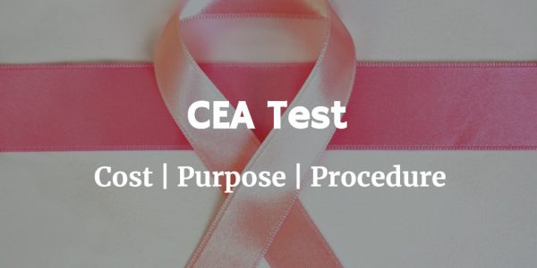 Know more about the CEA test including the CEA test cost, normal CEA levels, CEA test results and procedure for the test.