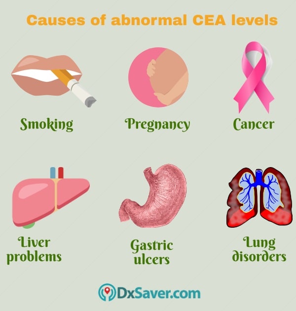 Know more about the causes of abnormal CEA levels.
