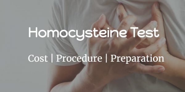 Know about the homocysteine test cost, normal homocysteine levels, test procedure and risks of high homocysteine levels