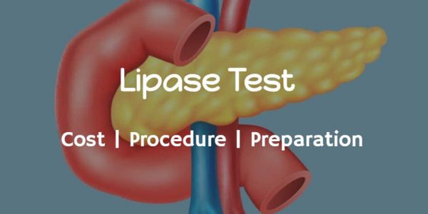 Know more about the lipase test cost, normal lipase range, lipase test procedure and preparation.