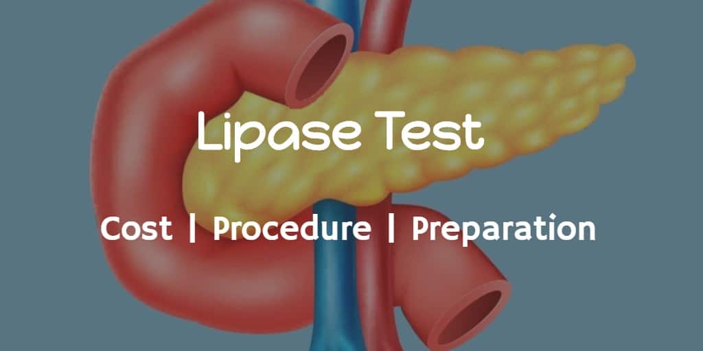 Know more about the lipase test including the lipase test cost, procedure and preparation of lipase test.
