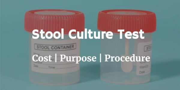 Know more about the stool culture test including the stool culture cost, types of stomach infections, test procedure & risks