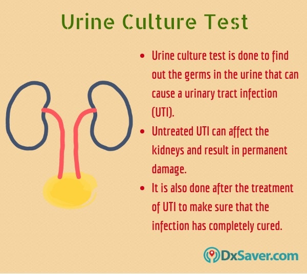 Know more about the urine culture and the importance of taking the urine culture test.