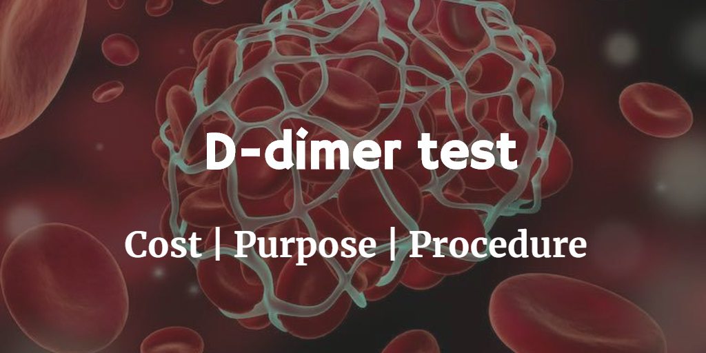 Know more about the d-dimer test including the D-dimer test cost, the purpose, and procedure of the test.