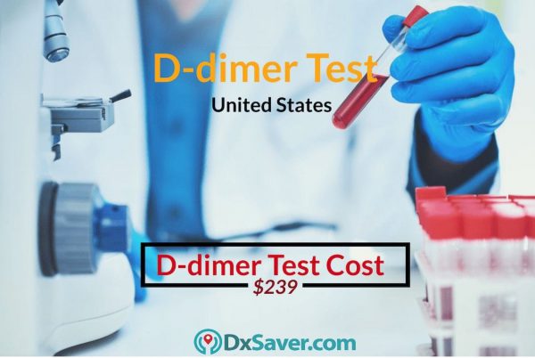 D dimer Test Cost in the US. Know more about what is D-dimer test and procedure