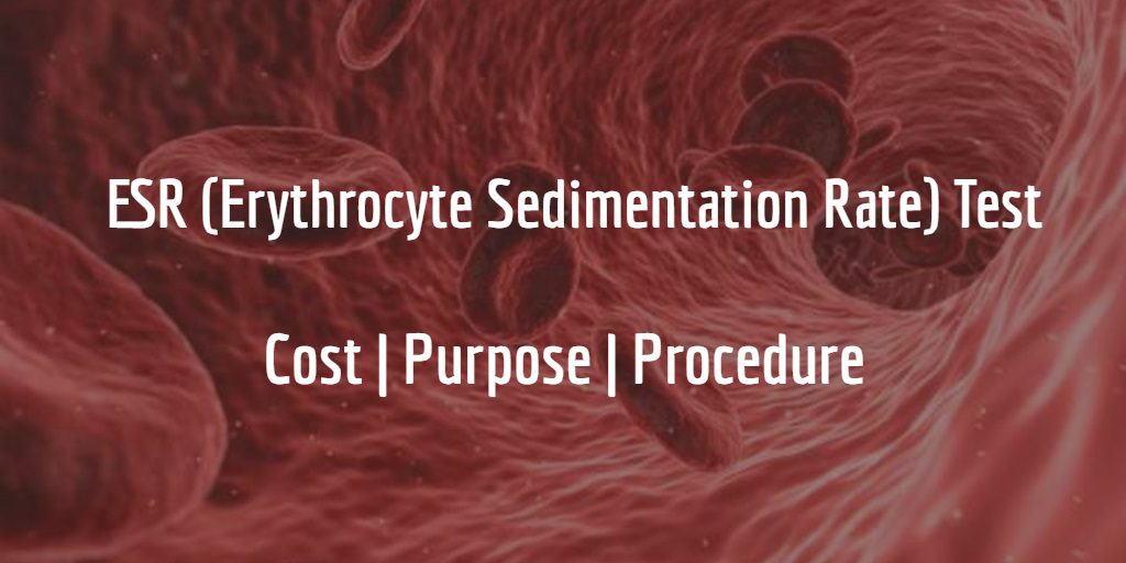Know more about the ESR test including the ESR test cost, purpose, and procedure of the test.