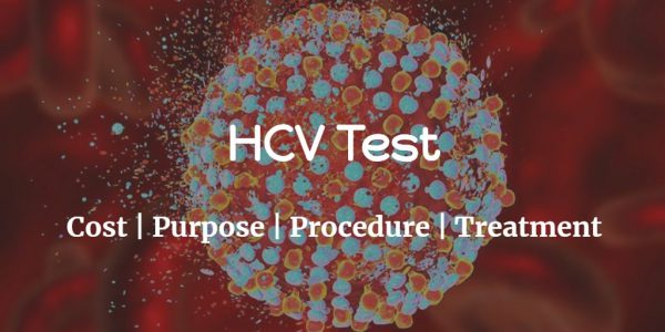 Know more about the hepatitis C virus including the HCV test cost, test purpose and procedure of the test.