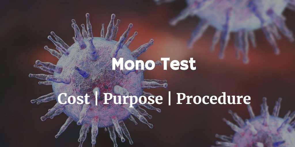 Know more about the mononucleosis test like the mono test cost, signs of mono, mononucleosis treatment & more.