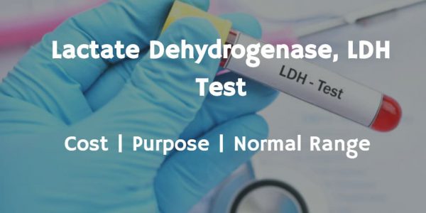 Know more about the LDH test like LDH test cost, normal LDH levels, test procedure and risks.