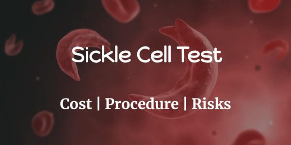 Know more about the sickle cell test including the sickle cell disease test cost, what causes sickle cell disease, sickle cell disease symptoms, treatment of sickle cell anemia, test procedure & risks.