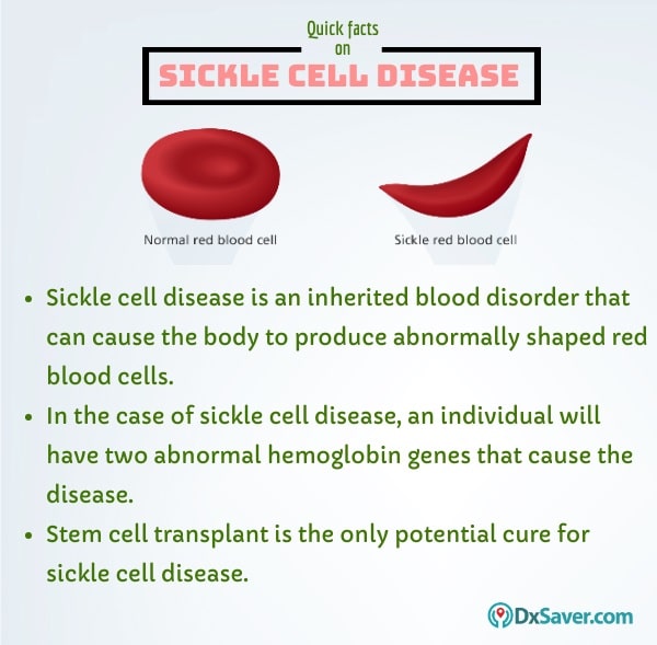 Know more about the meaning of sickle cell disease.