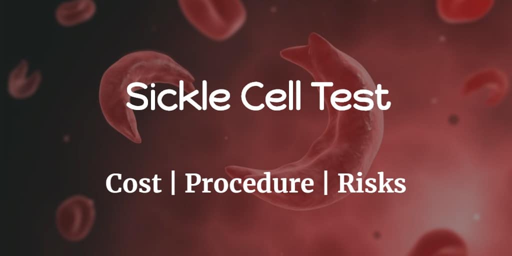 This image represents sickle red blood cells. Know more about the sickle cell test including the sickle cell disease test cost, procedure, and risks of the test.