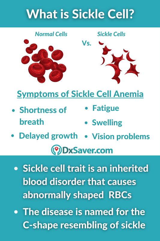 What is Sickle Cell Anemia