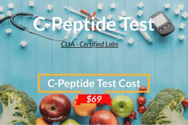 Know more about the C-Peptide test including the C-peptide test cost, C-Peptide normal levels, procedure of the test and more.