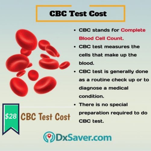 Know more about CBC test and the cost of CBC test in the U.S.