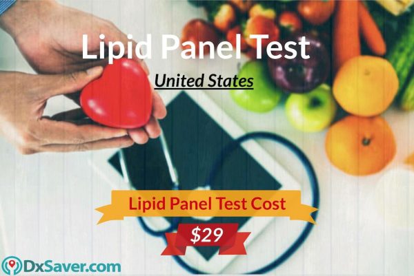 Lipid Panel Test Cost, Know more about what is lipid profile test for, lipid panel levels, cholesterol range and more