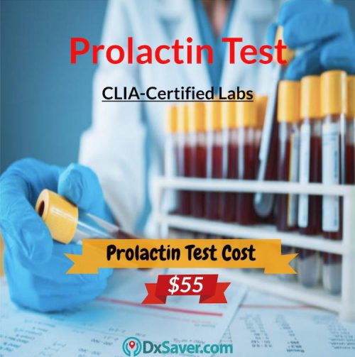 Know more about prolactin test cost in the U.S, what is a prolactin test?, prolactin levels normal range, procedure, and risks.