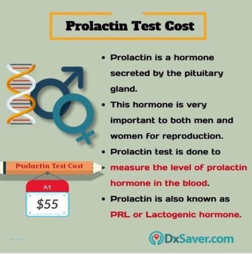 Know more about the prolactin test cost in the U.S. and why the prolactin test is done.