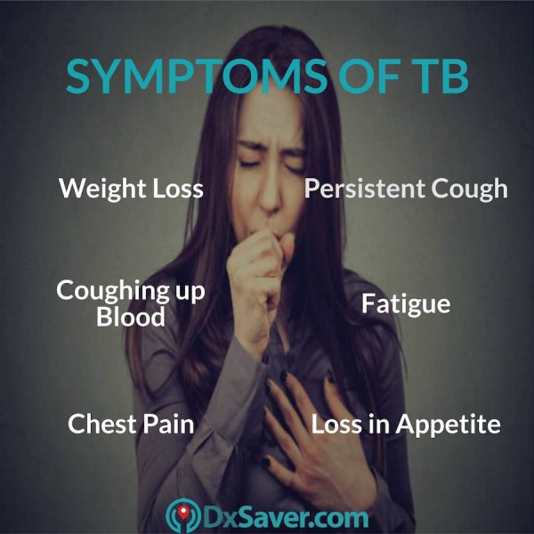 What are the symptoms of active tuberculosis.