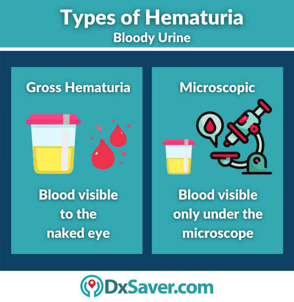 Hematuria meaning