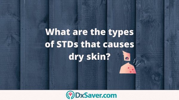 Know more about what STD cause dry skin and other symptoms in women and men