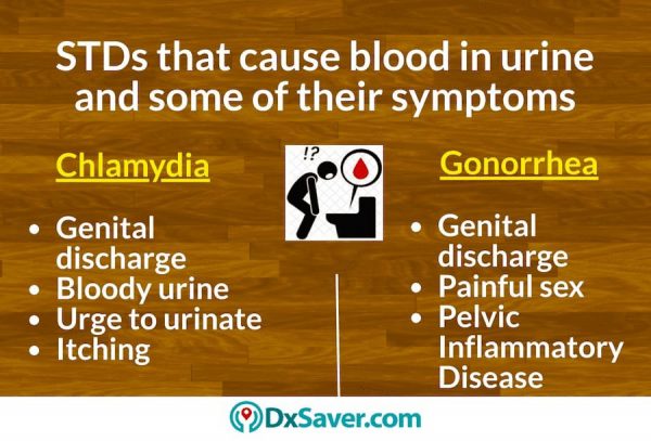 Know more about what STDs will cause blood in urine in men and their symptoms